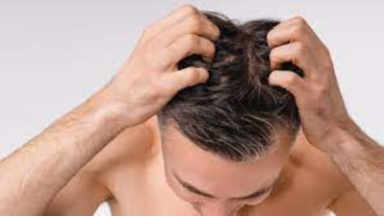 5 Ways to Deal with Hair Loss or Thinning